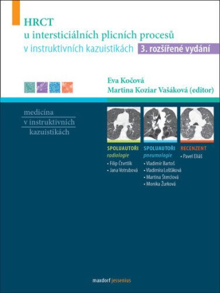HRCT u intersticiálních plicních procesů v instruktivních kazuistikách - kolektiv autorů,Eva Kočová,Martina Koziar Vašáková