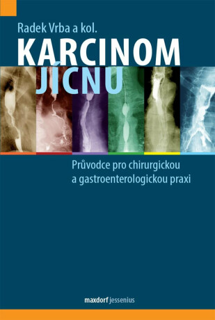 Karcinom jícnu - kolektiv autorů,Vrba Radek